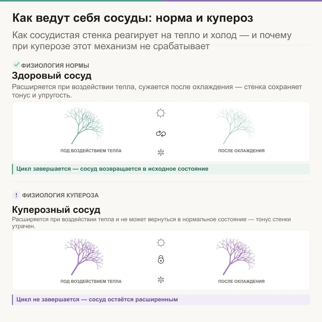 сосуды