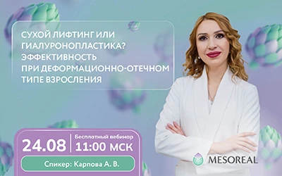 Вебинар 